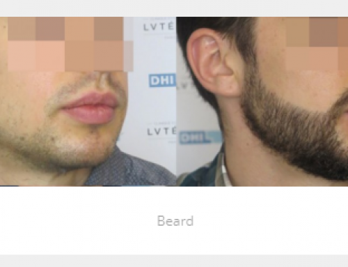 mustache 1