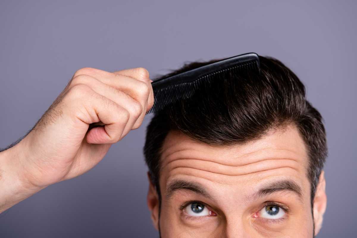 4 Hacks To Make Thinning Hair Look Thicker Mens Edition Dhi Mexico 