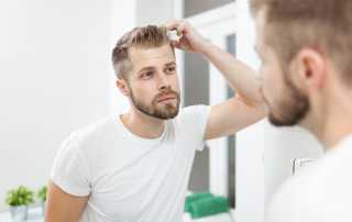 Handsome young man worried about hairloss