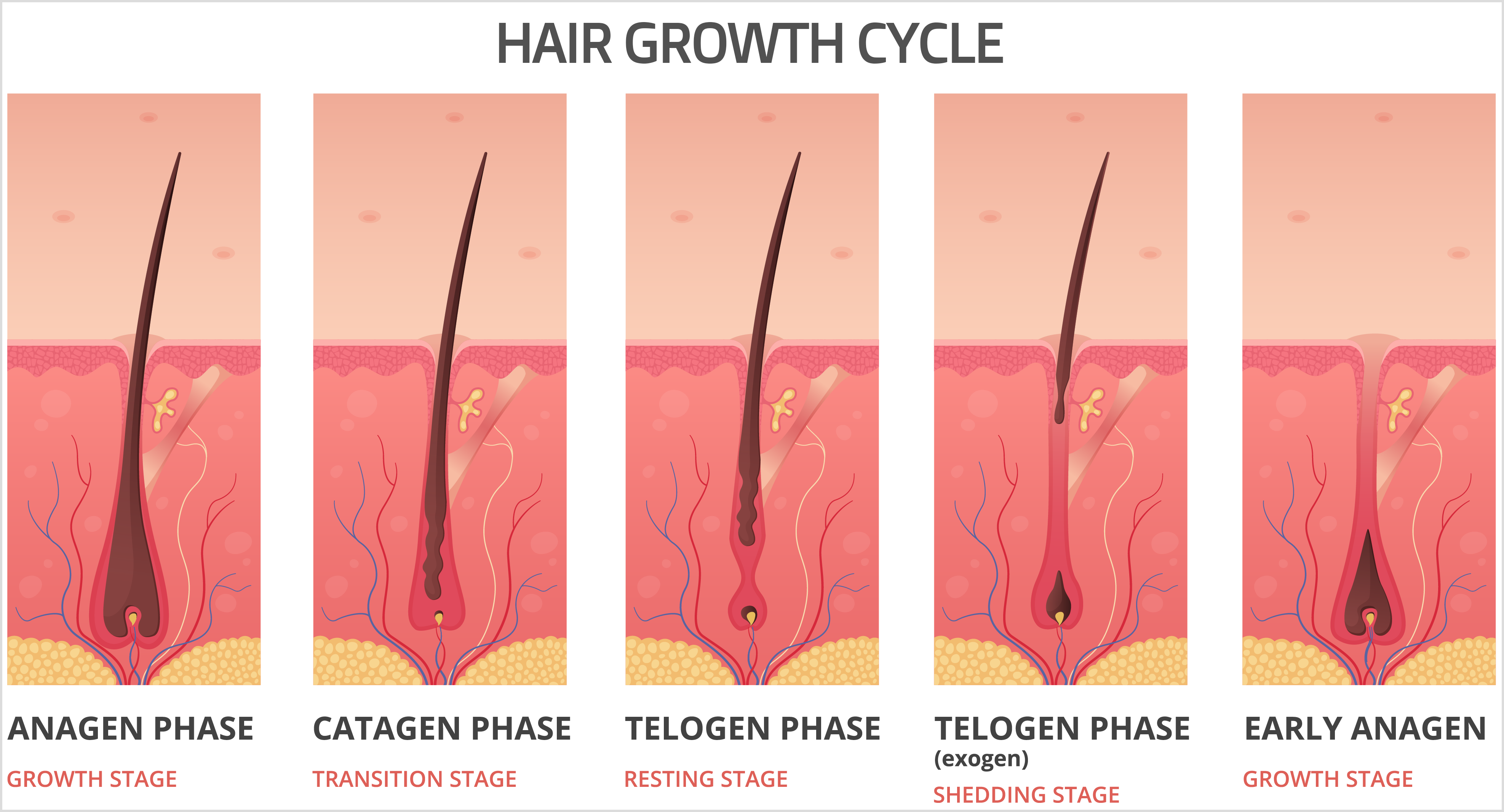 is-my-thyroid-condition-to-blame-for-my-hair-loss-dhi-mexico